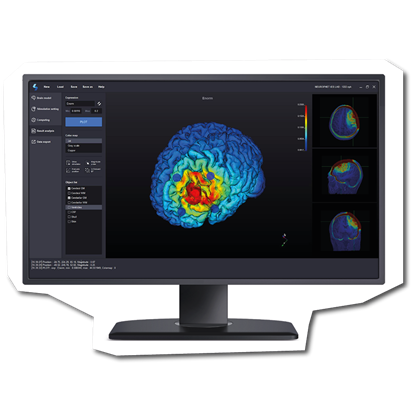 値下げに応じます。　　　　　　　The BrainD v2.tDCS 値下げに応じます。 The BrainD v2.tDCS 値下げに応じます。 The